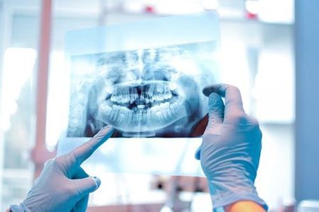 Tooth Care — Dental X-Ray in North Canton, OH