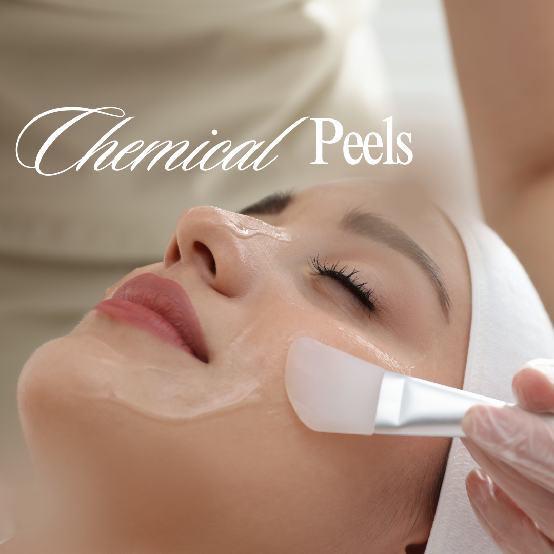 A chemical peel is a widely used cosmetic treatment to refresh the skin, stimulate collagen producti