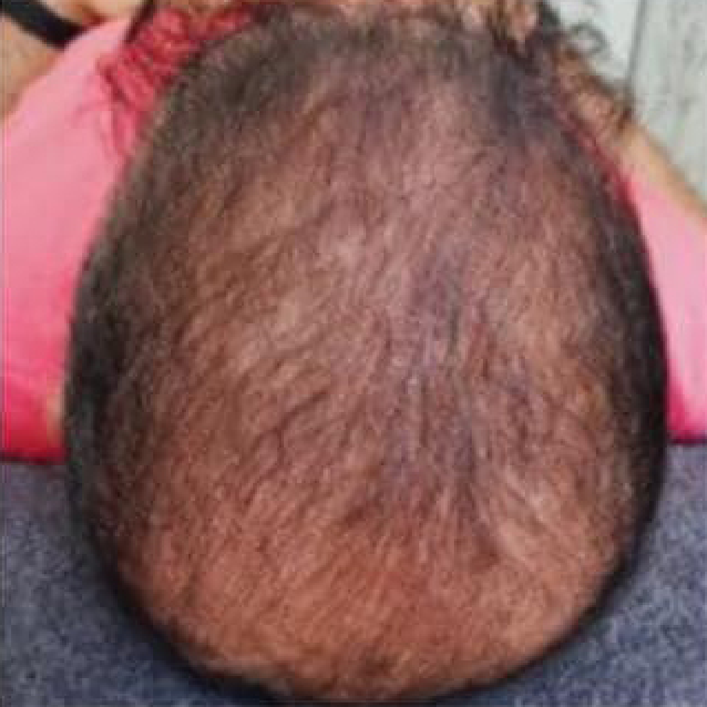 Eine Nahaufnahme vom Kopf eines Babys mit einem rosa Hemd.