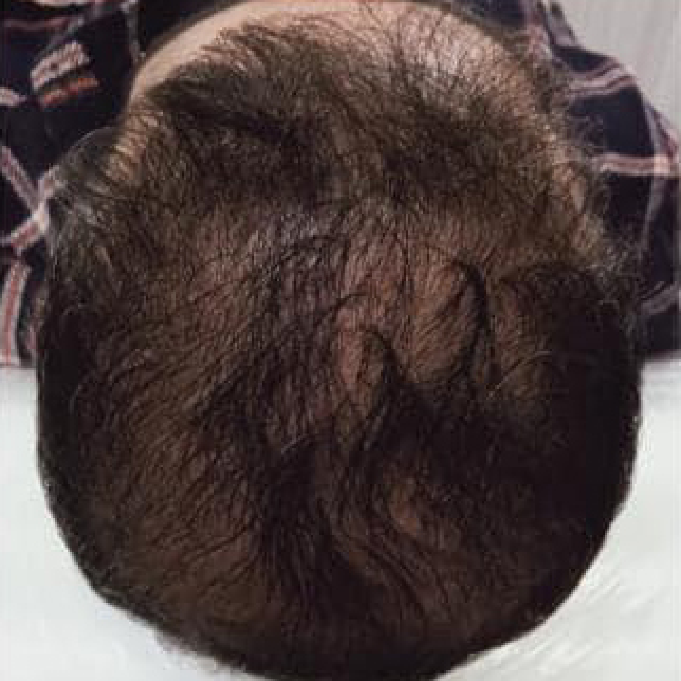 Eine Nahaufnahme des Kopfes eines Mannes mit viel Haar.