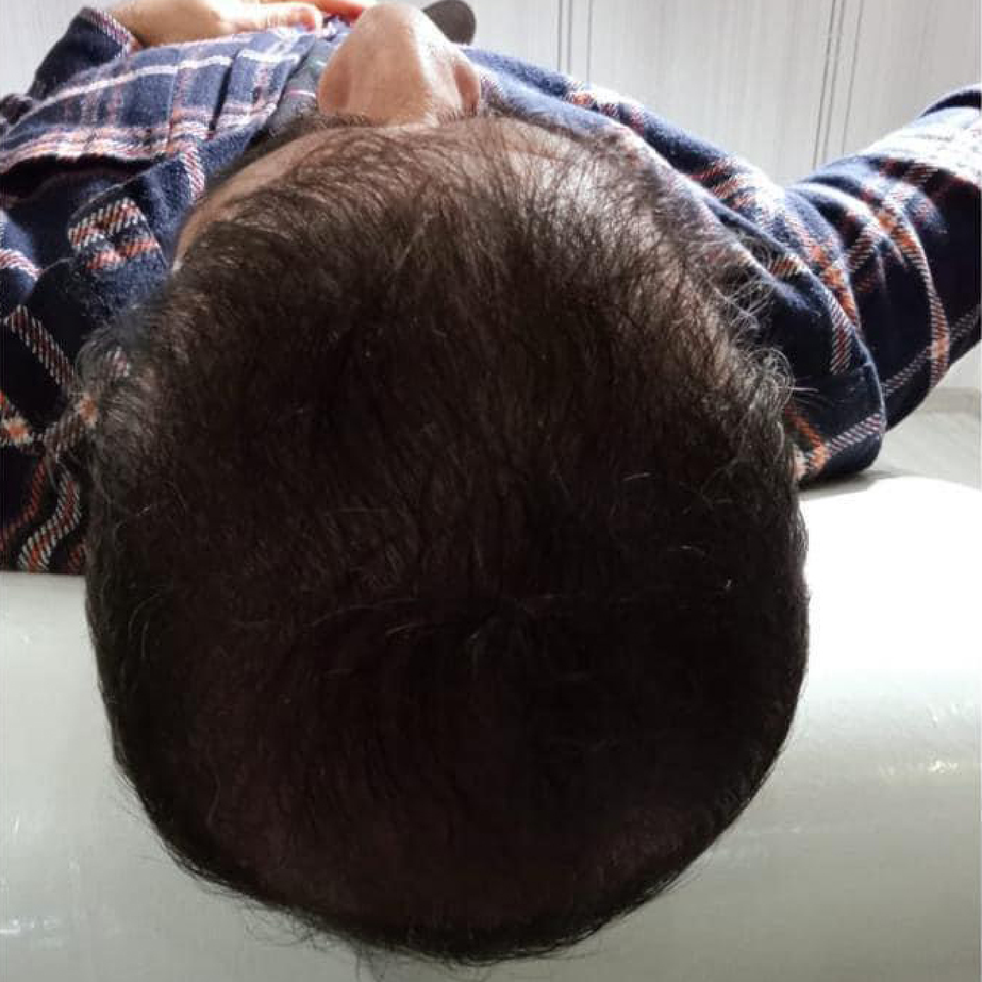 Eine Nahaufnahme des Kopfes einer Person mit einem karierten Hemd