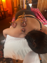 Cupping massage