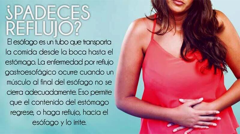 DR. SERGIO U. ACOLTZI ESCORCIA - REFLUJO