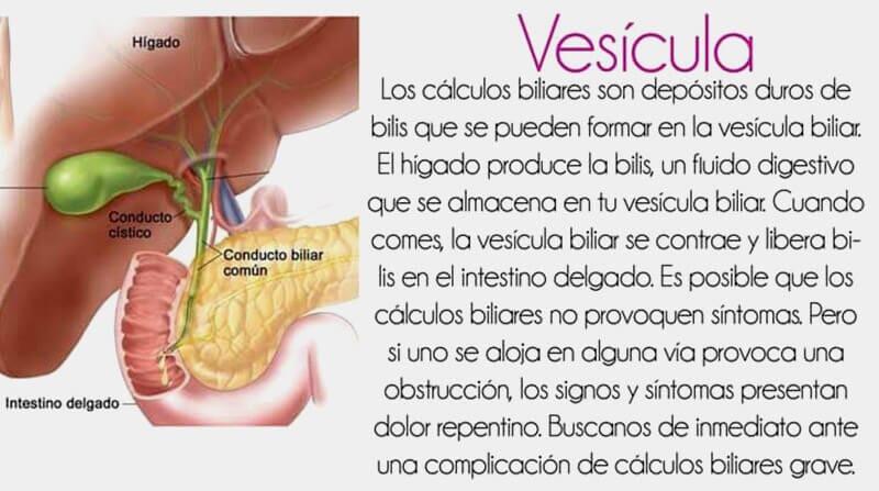 DR. SERGIO U. ACOLTZI ESCORCIA - VESÍCULA