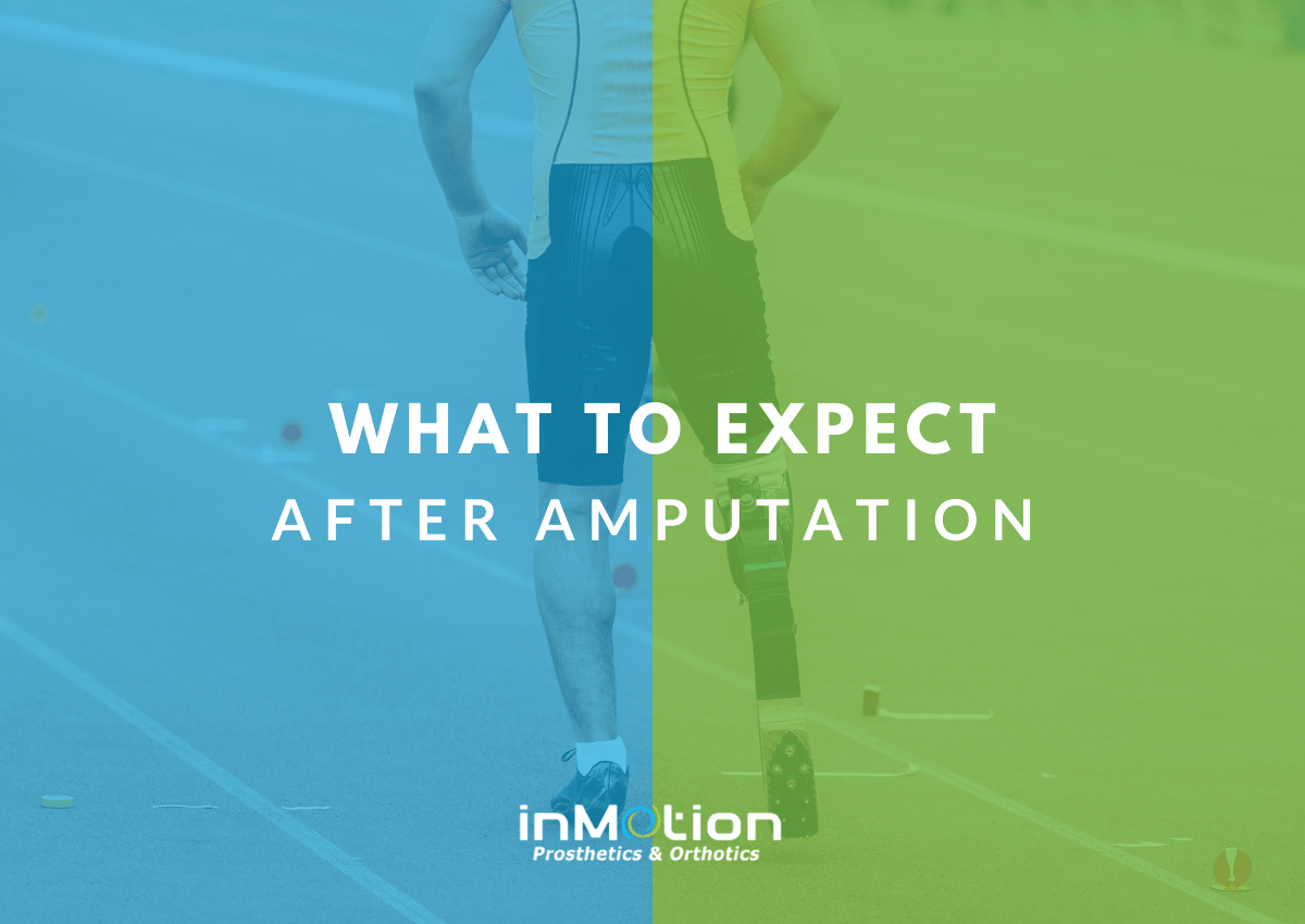 What To Expect After Your Amputation