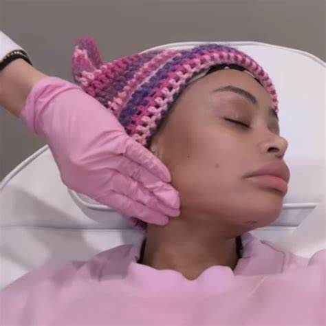 Blac Chyna reveals results of removing her facial fillers following her breast and butt reduction: 'It was making my face look like a box'
