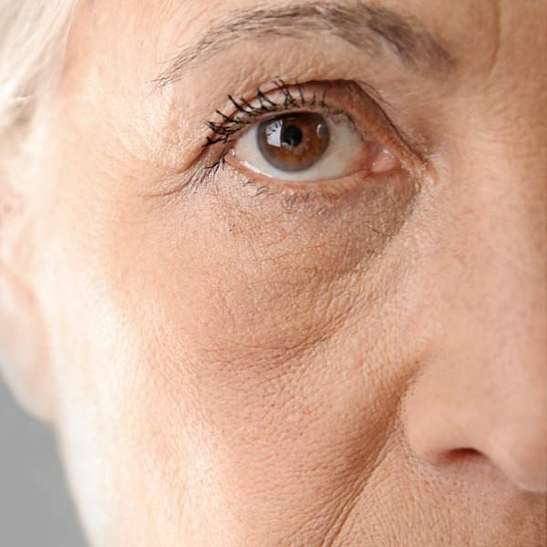 Close up of woman's face Before and After Acu-Lift Technique Treatments