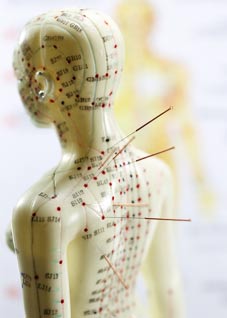 Learn What is Acupuncture and How Does it Work from Acupuncturist in NYC Marc Bystock L.Ac. Located in Midtown Manhattan NY 10016