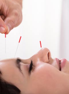 Acupuncture Treatment for Anxiety by Marc Bystock, NYC Acupuncturist in Midtown Manhattan NY 10016