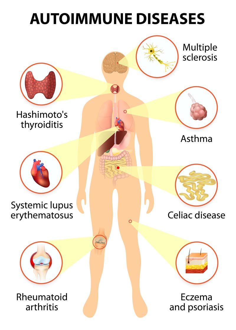 Holistic Healthcare Treatments for tissues of the human body affected by autoimmune attack