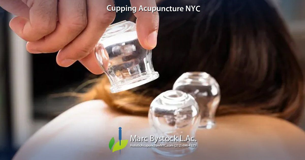 Cupping Acupuncture NYC by Marc Bystock L.Ac.