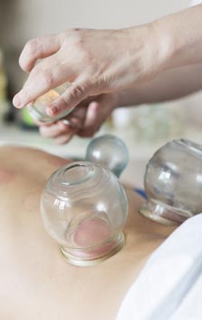 Cupping Acupuncturist in Midtown Manhattan NY 10016