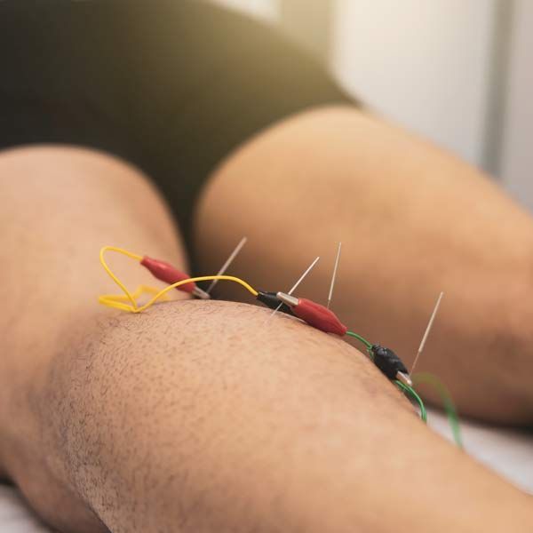 Man Receiving Electrical Stimulation Acupuncture from Marc Bystock, NYC Acupuncturist