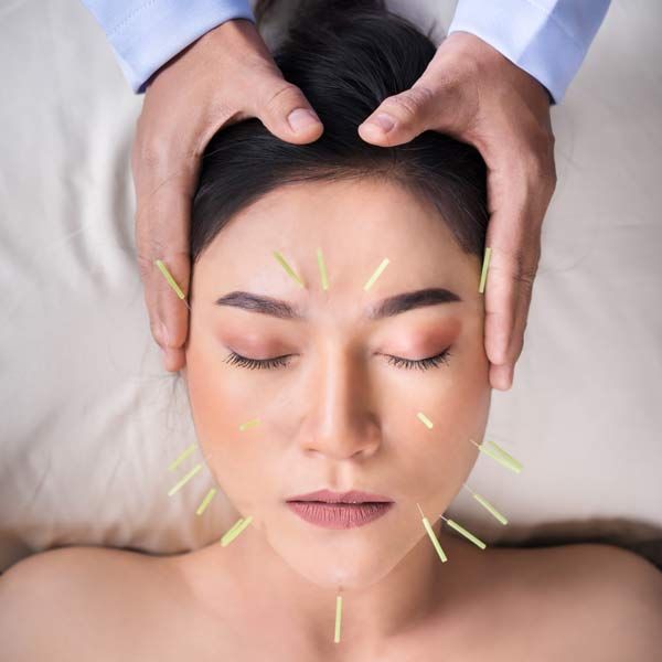 Woman Receiving Facial Acupuncture Treatment