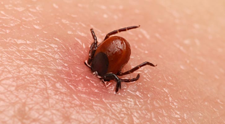 Lyme Disease Treatment NYC by Marc Bystock L.Ac.