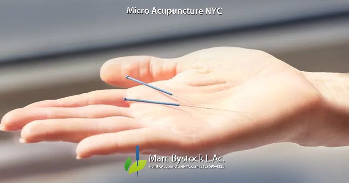 Micro Acupuncture NYC and Acunova by Marc Bystock L.Ac.