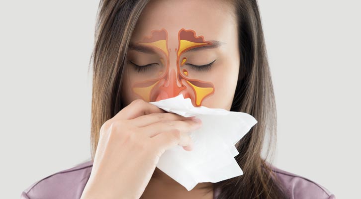 Sinusitis Treatment NYC by Marc Bystock L.Ac.