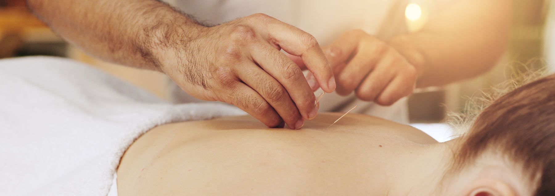 Surprising Acupuncture Treatments