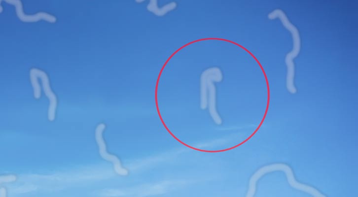 Eye Floaters Treatment NYC by Marc Bystock L.Ac.