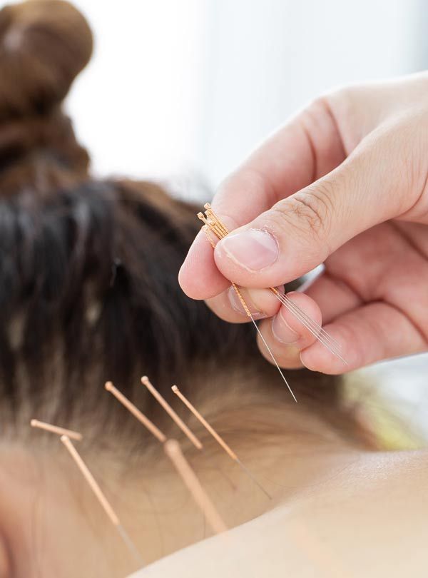 Closeup of a patient with neck pain representing Acupuncture Treatments for Severe and Chronic Neck Pain by Marc Bystock, NYC Acupuncturist in Midtown Manhattan, NY 10016