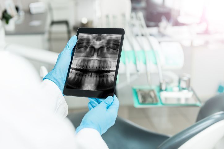 A person wearing blue medical gloves holds a tablet displaying a dental panoramic X-ray in a clinical office setting.