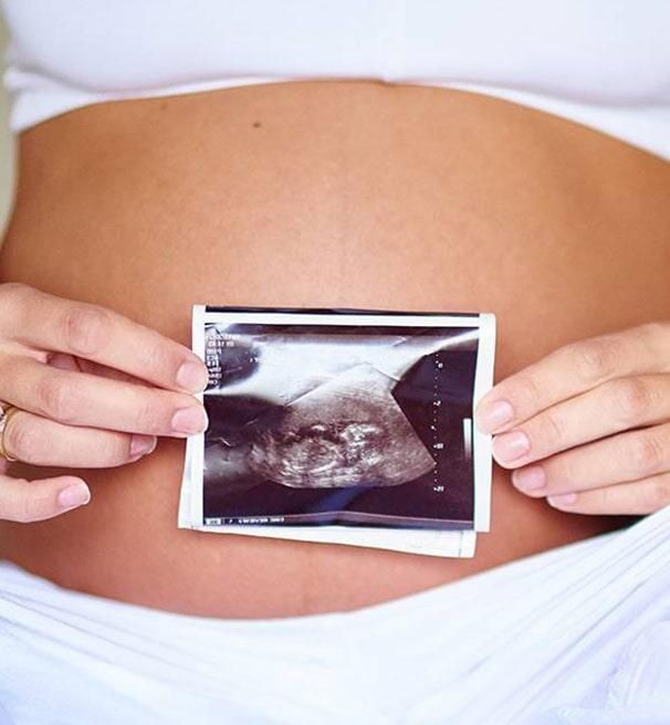 DRA MARÍA ELENA VELDERRAIN ZAZUETA