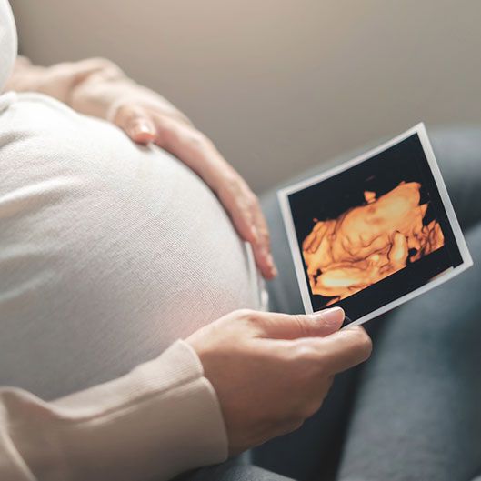 DRA MARÍA ELENA VELDERRAIN ZAZUETA