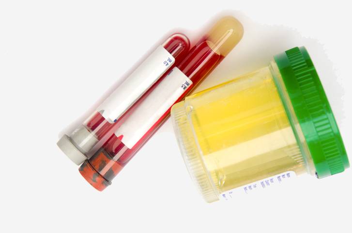 Contenitori per campioni