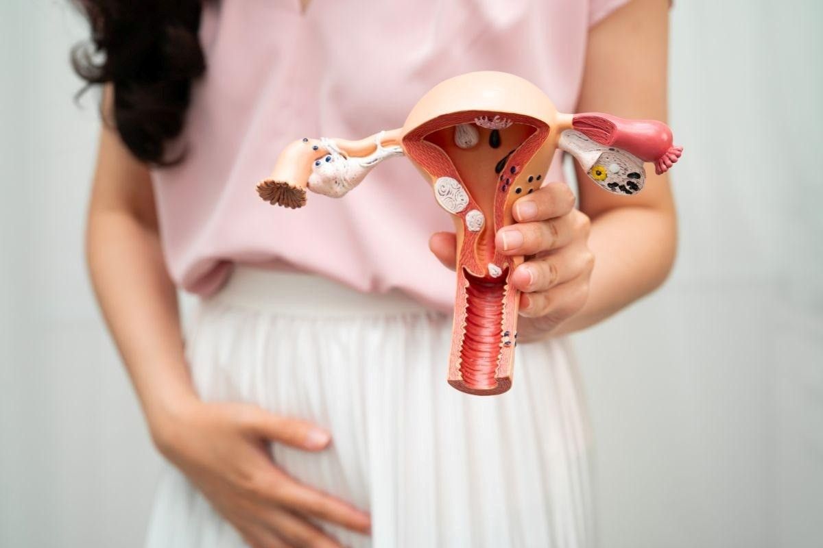 Bartholinectomia: como é a cirurgia para cisto de Bartholin