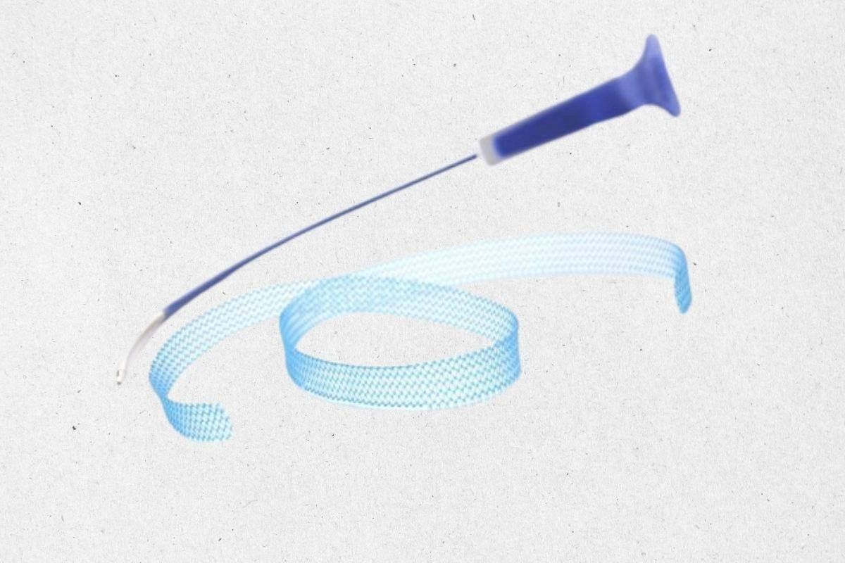 cirurgia-sling-como-funciona-dra-camila-poccetti-ginecologista-sao-paulo