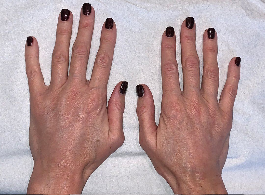 Hands after