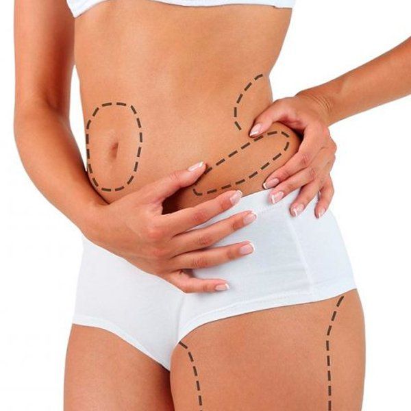 Body Contouring and Lipolysis Sarah Burns Orthodontics