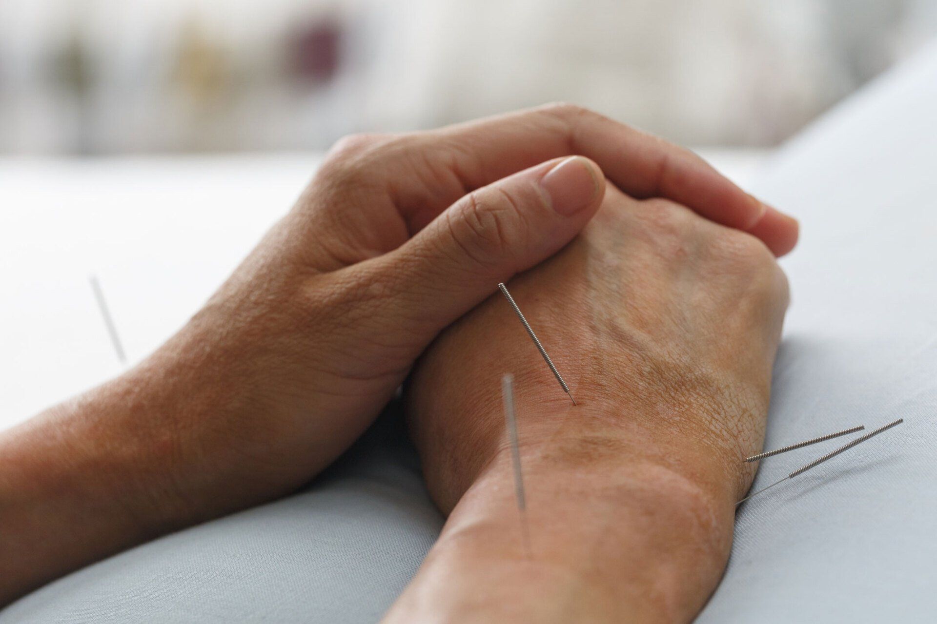 The Patient Had a Lot of Acupuncture on His Hand — Plympton, SA — Aaron Slape Acupuncturist