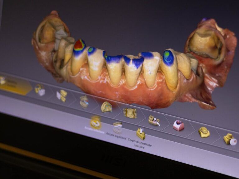 Mandibola dipinta con denti colorati esposti su una superficie grigia con piccoli campioni di denti sottostanti