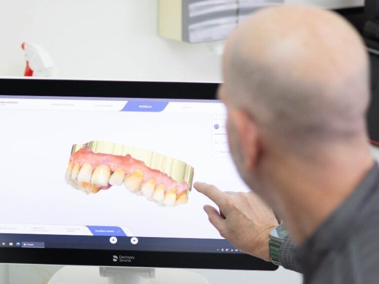 Una persona indica un modello dentale 3D su un monitor di computer.