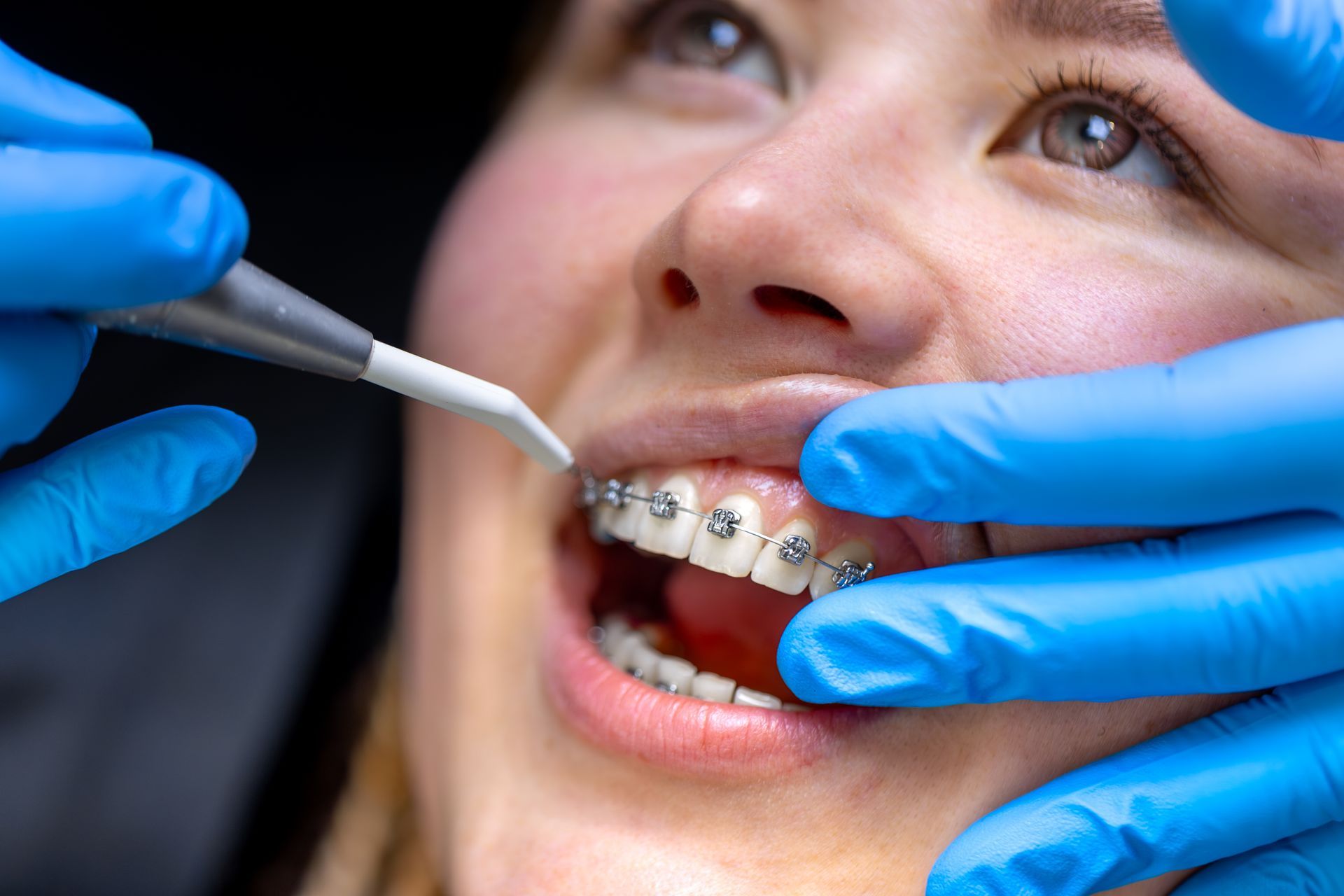 Una persona indica un modello 3D dentale sullo schermo di un computer.
