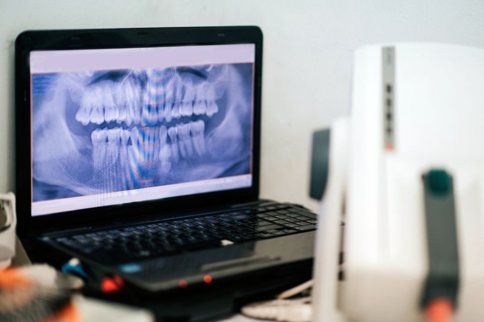 Computer con radiologia dentale