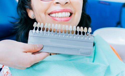 A woman is sitting in a dental chair holding a tooth color chart.