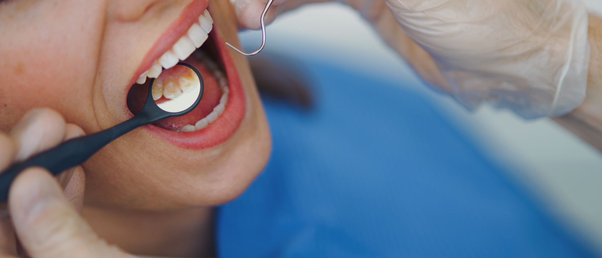 A dentist examining a patient's teeth using a mirror. Blue backdrop.