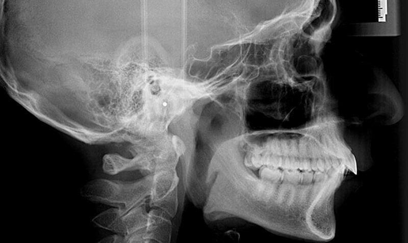 DR. CARLOS SÁNCHEZ GUTIÉRREZ - CIRUGÍA FACIAL