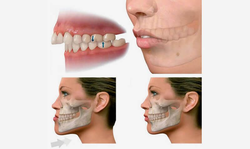 DR. CARLOS SÁNCHEZ GUTIÉRREZ - CIRUJANO FACIAL