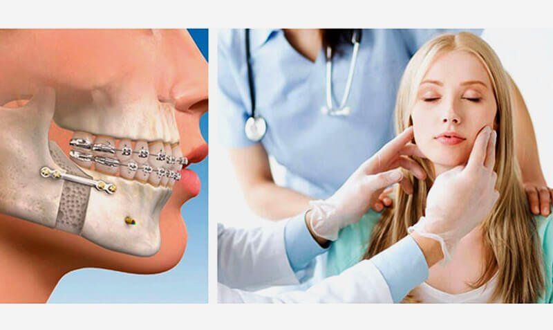 DR. CARLOS SÁNCHEZ GUTIÉRREZ - ATENCIÓN A PATOLOGÍAS MAXILOFACIALES