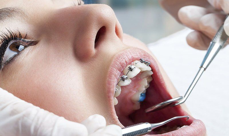 DR. CARLOS SÁNCHEZ GUTIÉRREZ - PROBLEMAS CON EL TERCER MOLAR RETENIDO