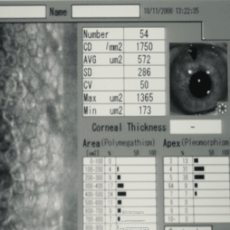 Microscopia endoteliale