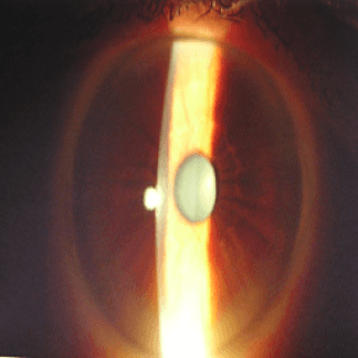 Esame biomicroscopico