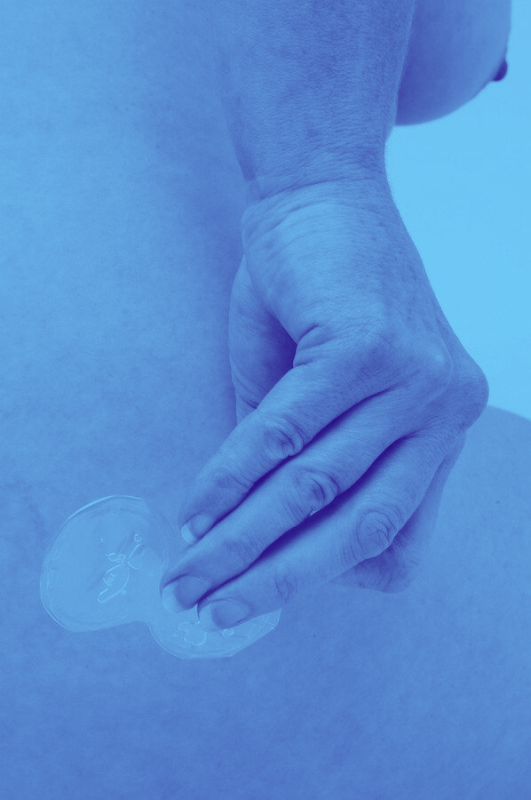 hormoonpleister op onderrug van vrouw