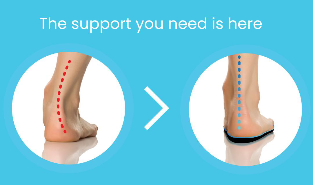 ustom orthotics graphic showing foot alignment support at Newcastle Podiatrist Clinic