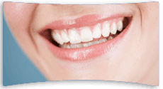 Close up of woman's smile showing straight teeth following a dental bridge