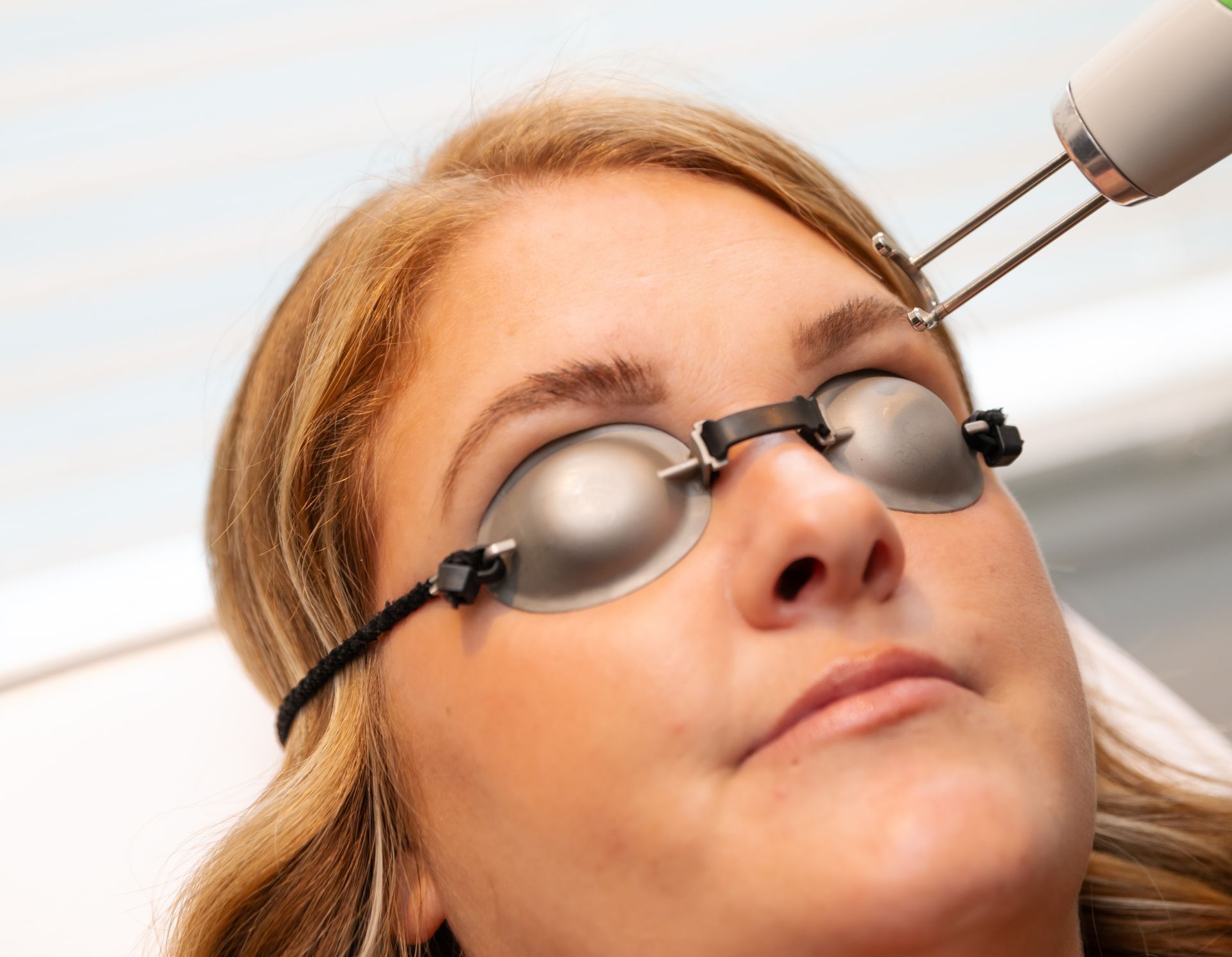 Someone receiving a laser microblading removal treatment near Lexington, Kentucky (KY)