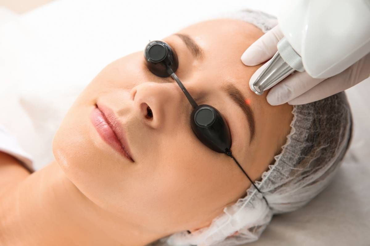 Someone receiving laser microblading removal near Lexington, Kentucky (KY)